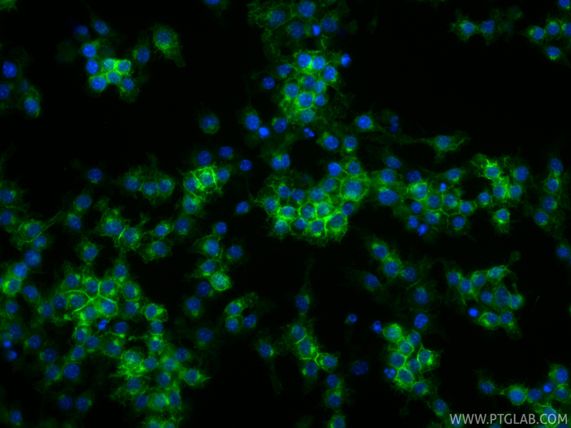 IF Staining of RAW 264.7 using CL488-84919-4 IF Staining of RAW 264.7 using CL488-84919-4