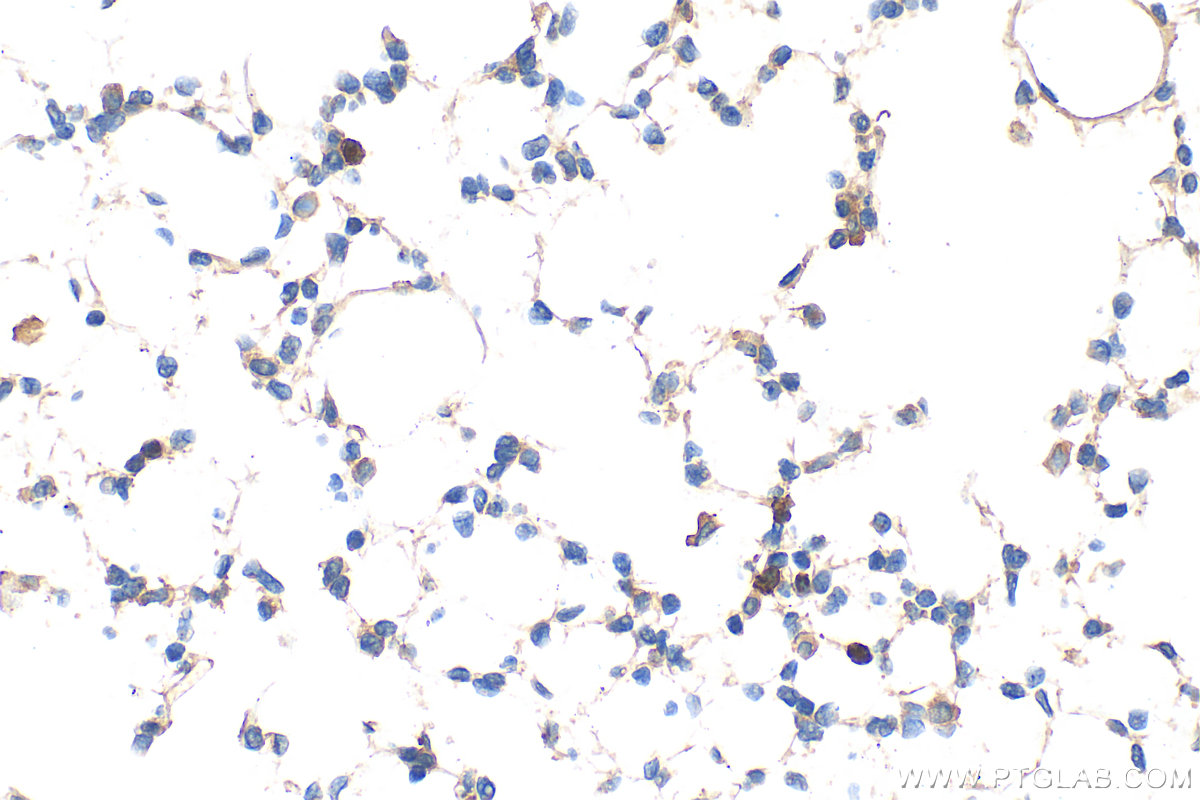 IHC staining of mouse lung using 32058-1-AP IHC staining of mouse lung using 32058-1-AP