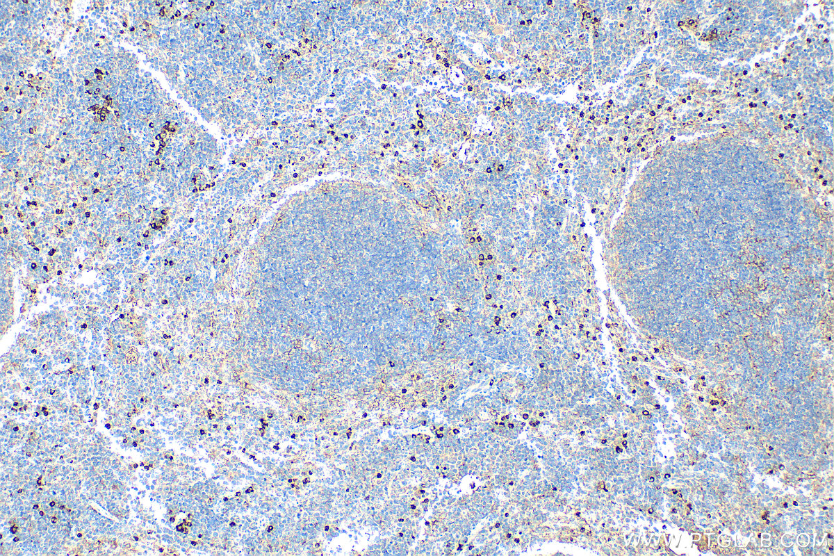 IHC staining of mouse spleen using 32058-1-AP IHC staining of mouse spleen using 32058-1-AP