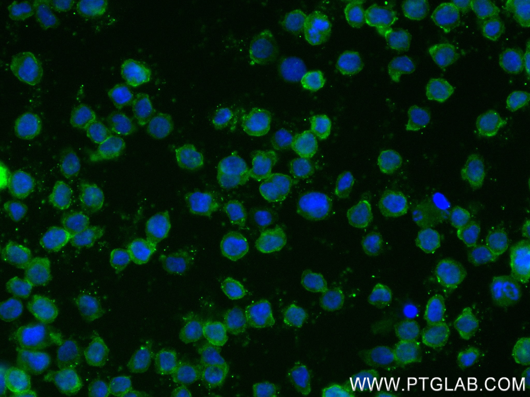 IF Staining of THP-1 using 84023-1-RR (same clone as 84023-1-PBS)