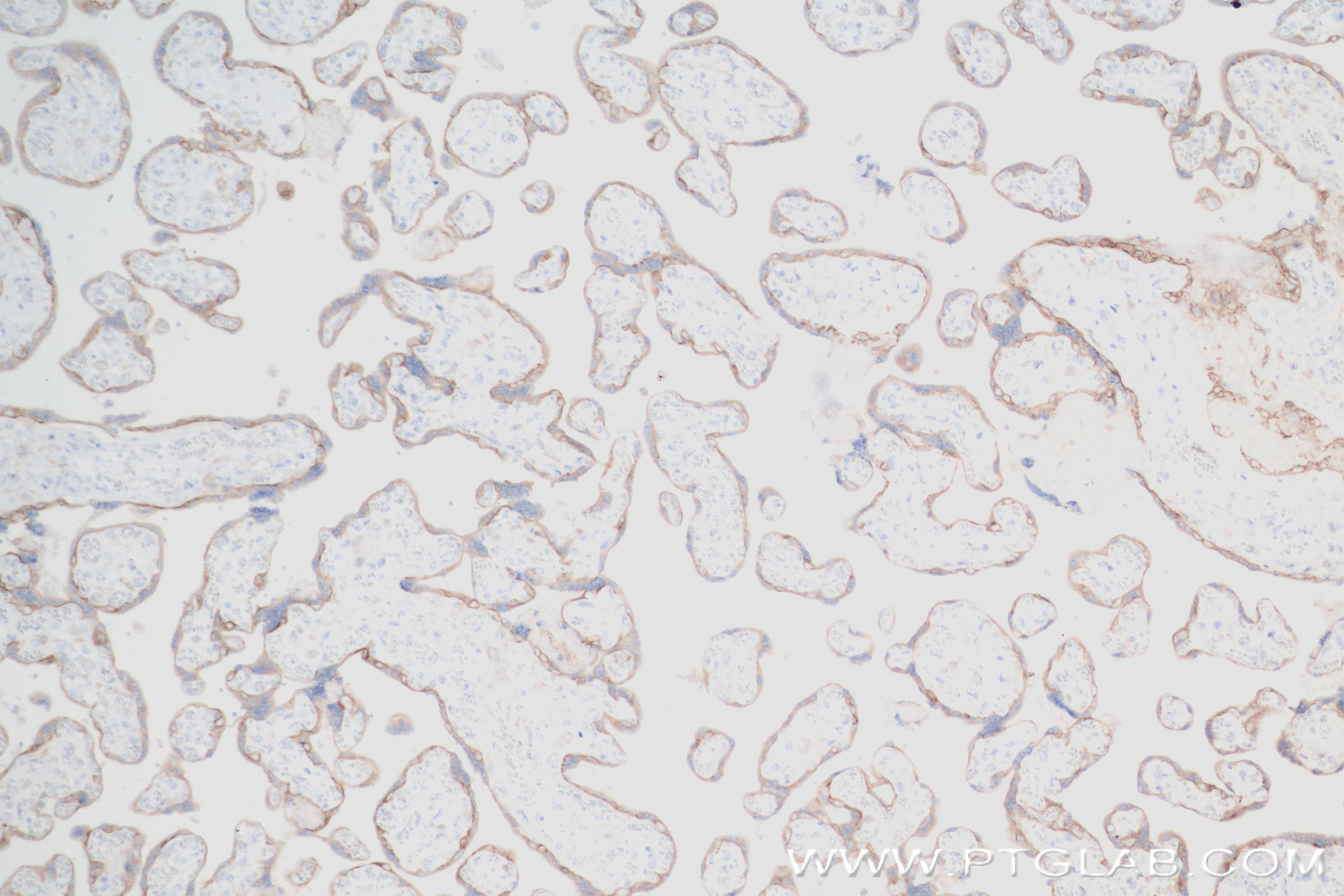 IHC staining of human placenta using 84023-1-RR (same clone as 84023-1-PBS)