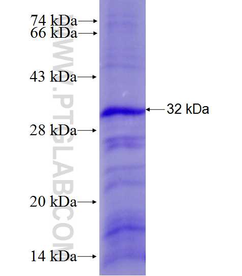 CSF2RB fusion protein Ag28170 SDS-PAGE