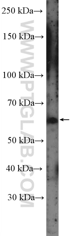 CSGALNACT1