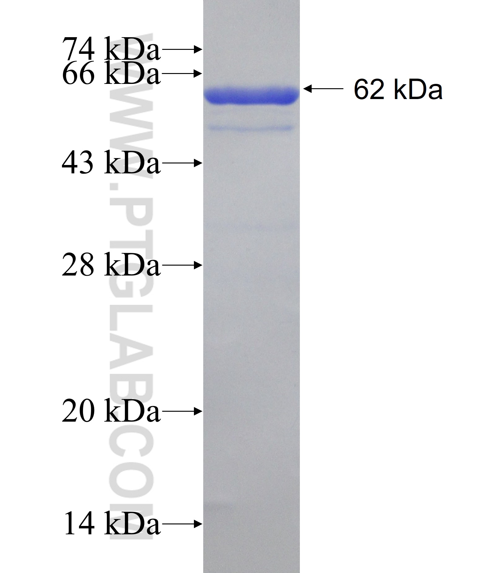 CSGALNACT2 fusion protein Ag31332 SDS-PAGE CSGALNACT2 fusion protein Ag31332 SDS-PAGE