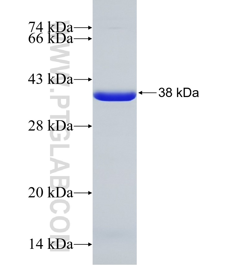 CSGALNACT2 fusion protein Ag31355 SDS-PAGE CSGALNACT2 fusion protein Ag31355 SDS-PAGE