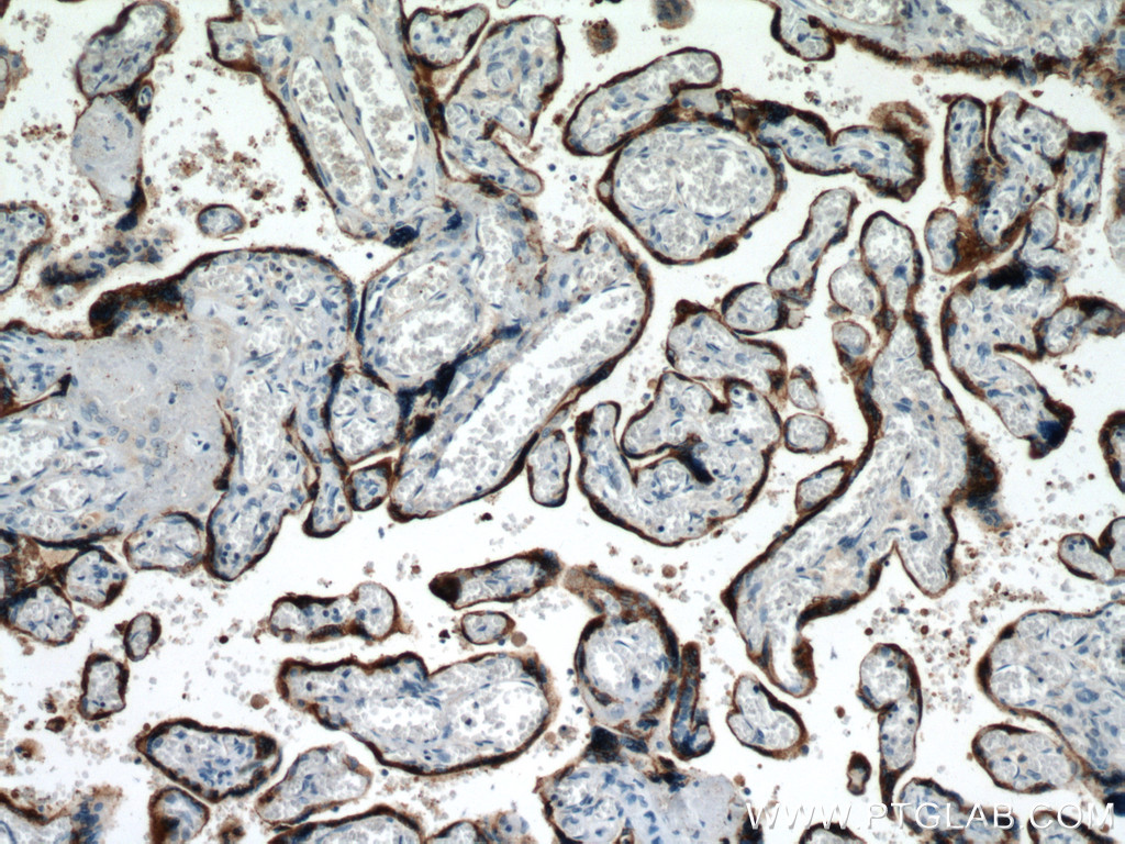 IHC staining of human placenta using 10178-1-AP