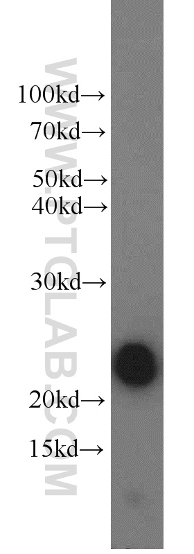 WB analysis of human placenta using 55236-1-AP