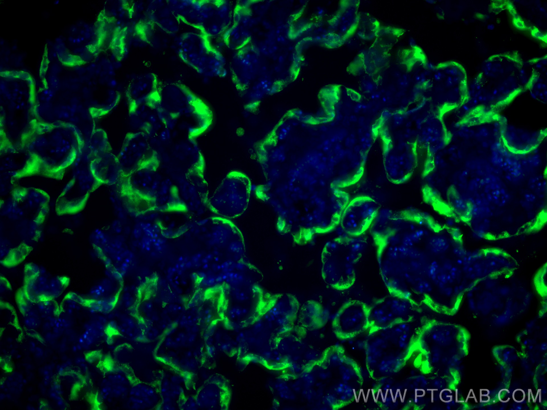 IF Staining of human placenta using 16326-1-AP