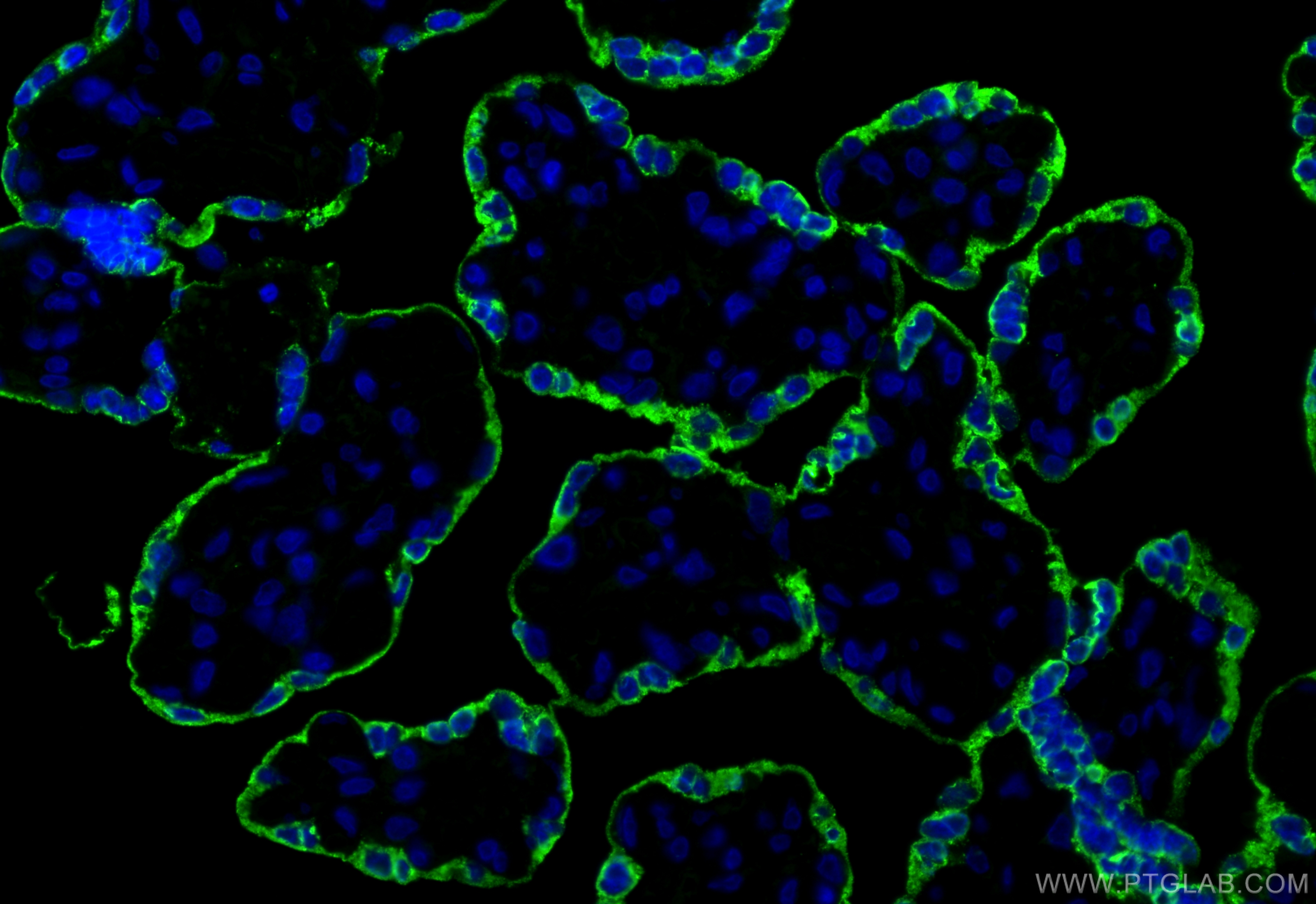 IF Staining of human placenta using 16326-1-AP