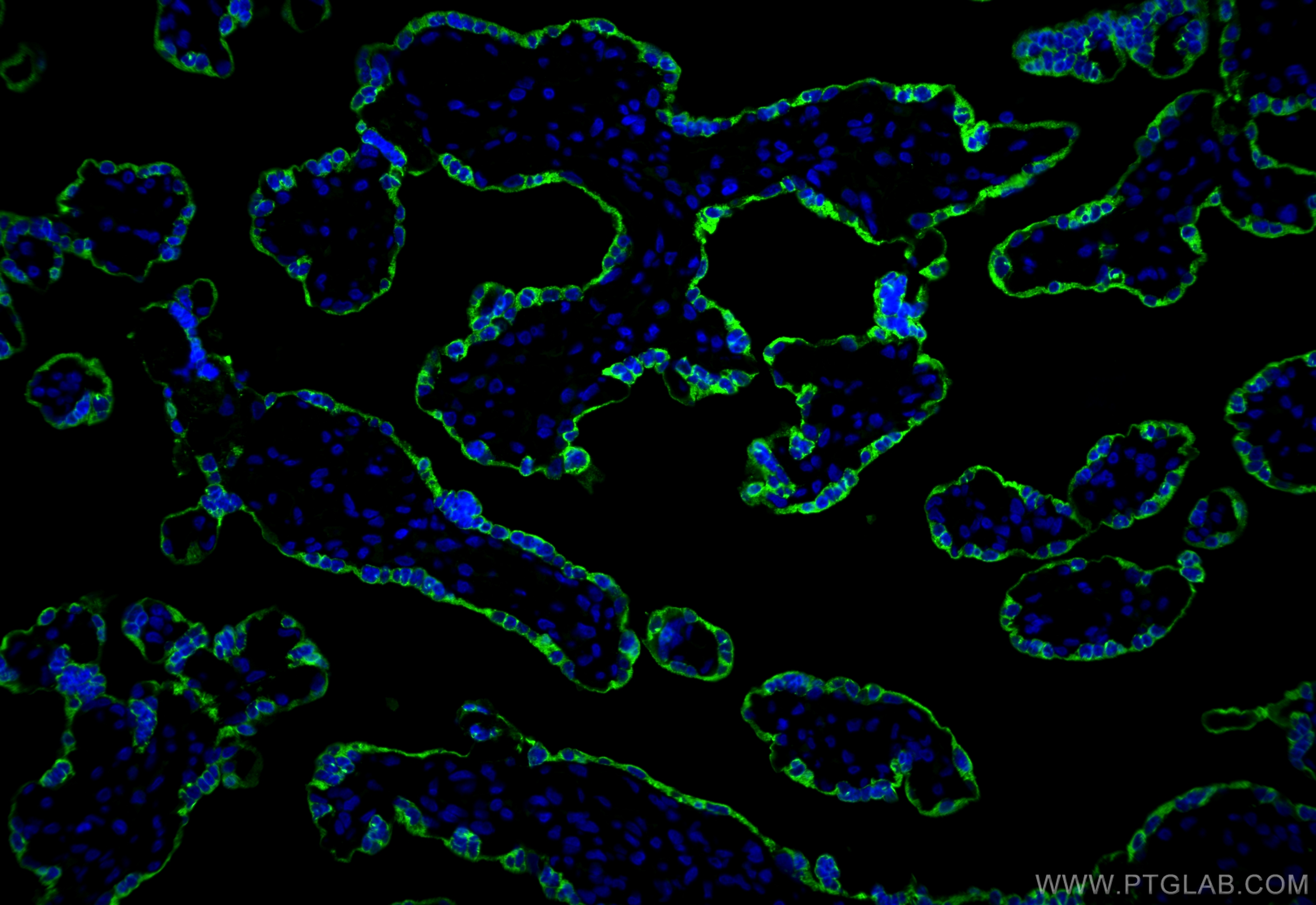 IF Staining of human placenta using 16326-1-AP