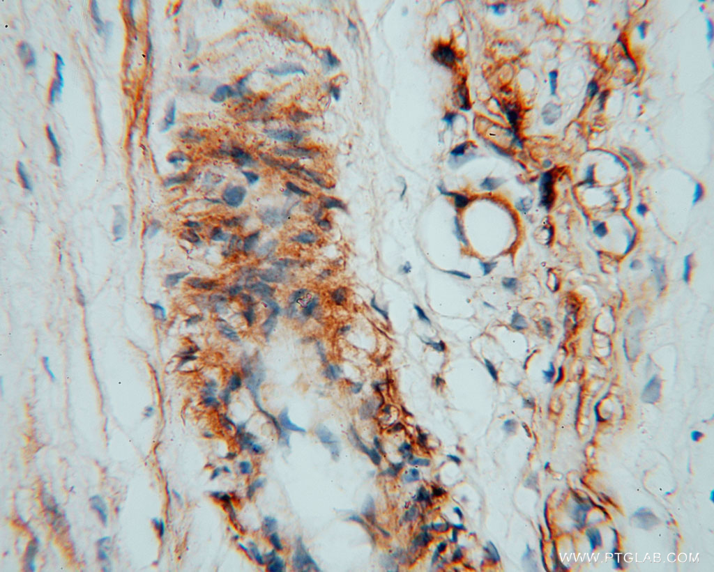 IHC staining of human placenta using 11883-1-AP