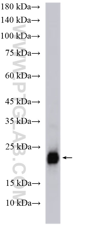 WB analysis of human placenta using 11883-1-AP (same clone as 11883-1-PBS) WB analysis of human placenta using 11883-1-AP (same clone as 11883-1-PBS)