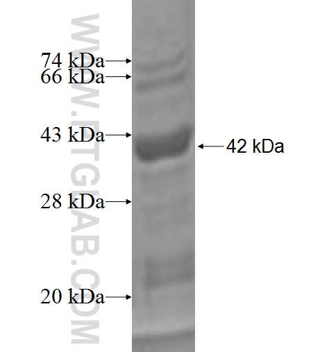 CSHL1 fusion protein Ag2487 SDS-PAGE