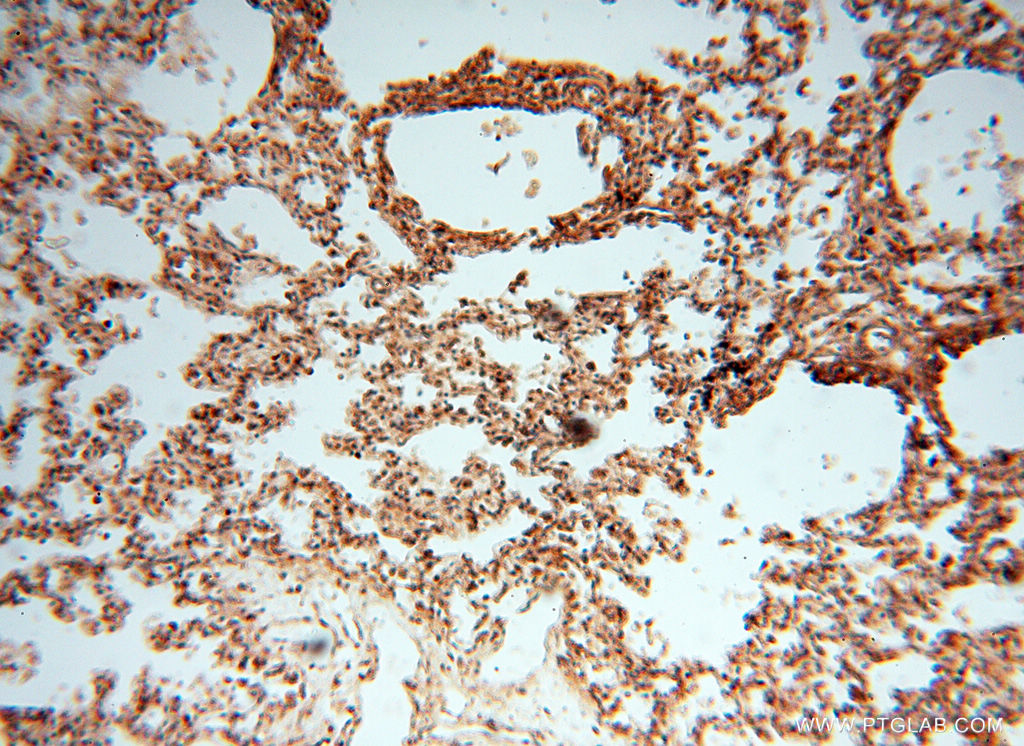 IHC staining of human lung using 17720-1-AP