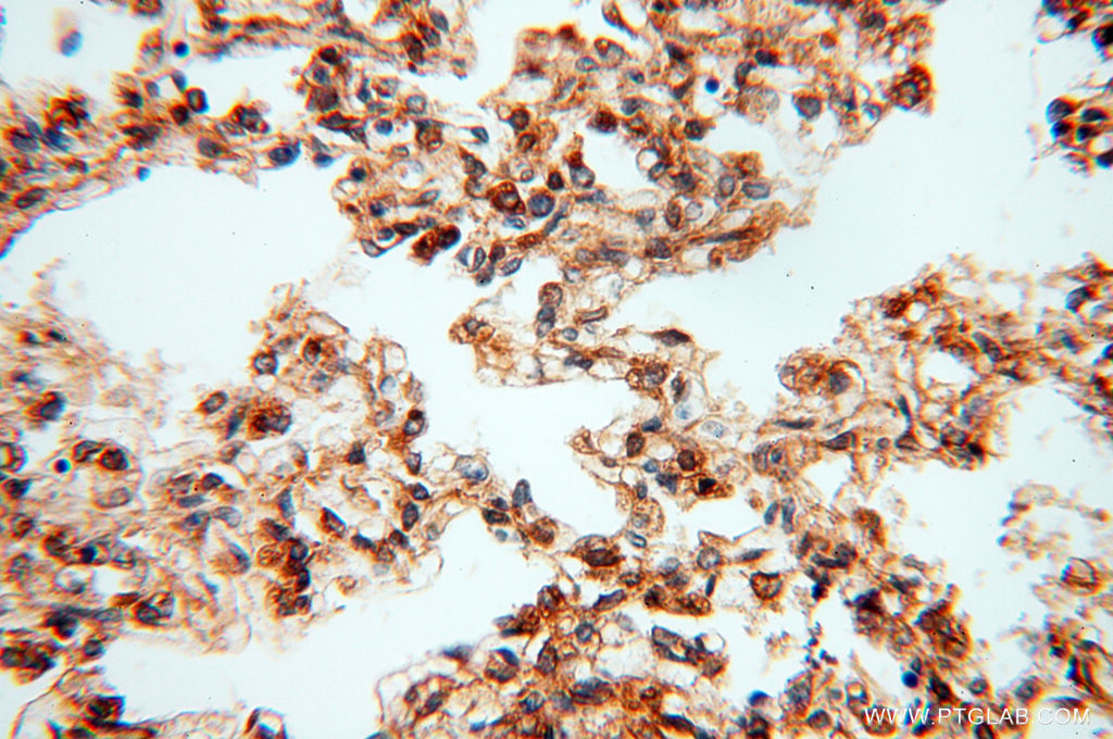 IHC staining of human lung using 17720-1-AP
