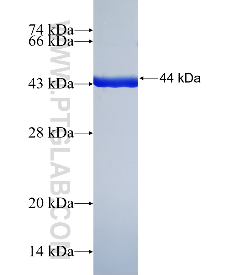 CSMD1 fusion protein Ag39219 SDS-PAGE