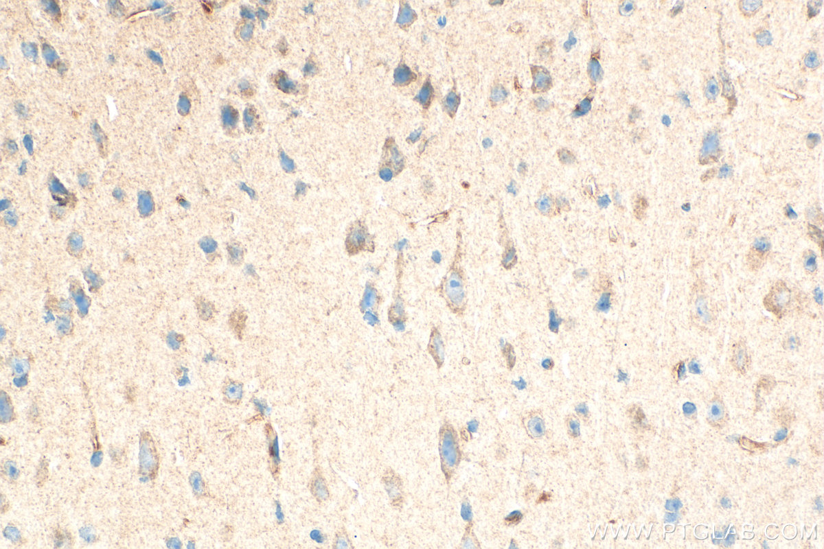 IHC staining of mouse brain using 31573-1-AP