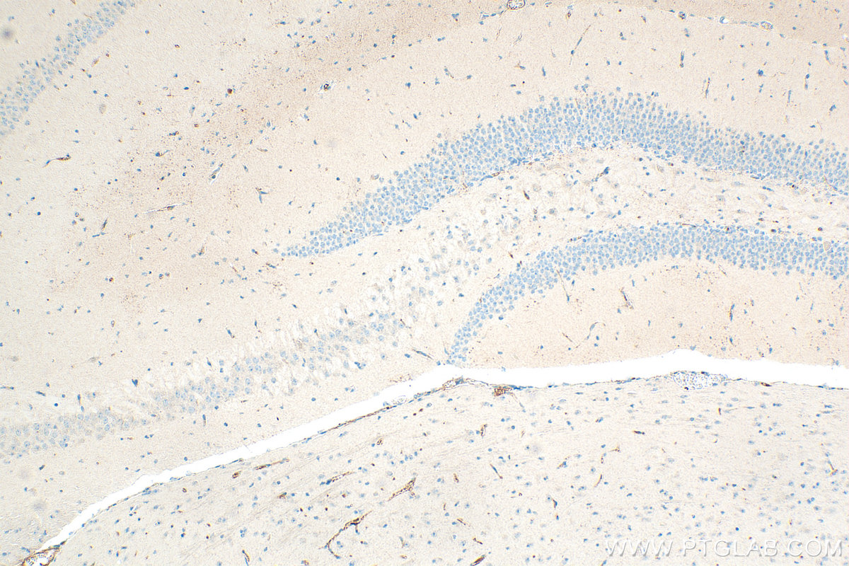 IHC staining of mouse brain using 31573-1-AP