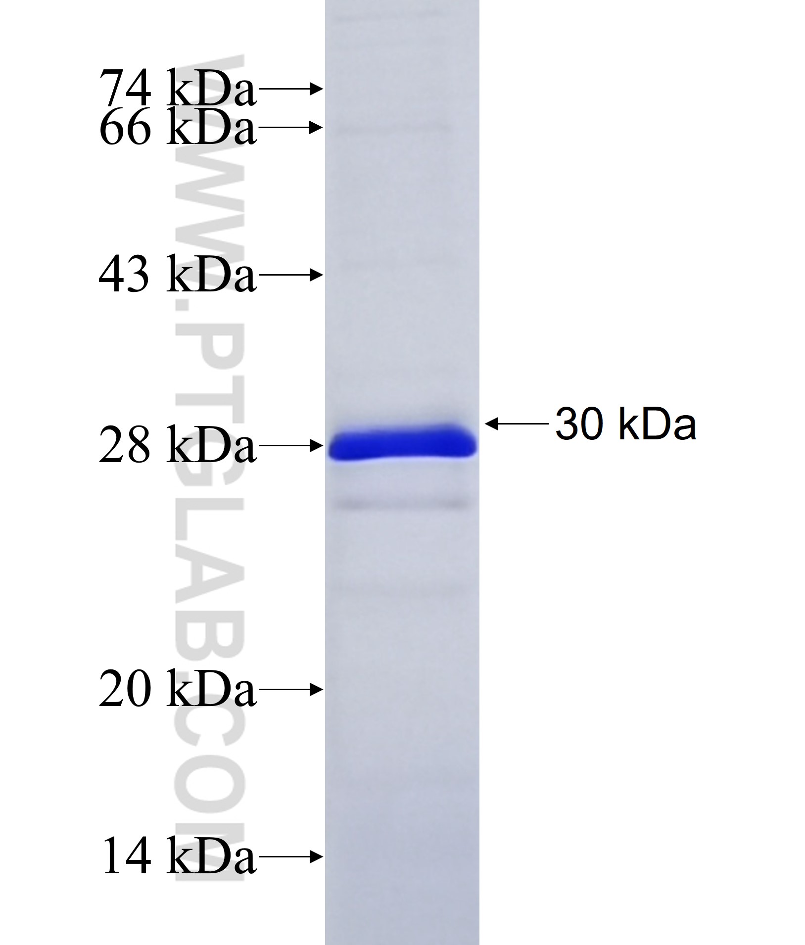 CSMD3 fusion protein Ag38030 SDS-PAGE CSMD3 fusion protein Ag38030 SDS-PAGE