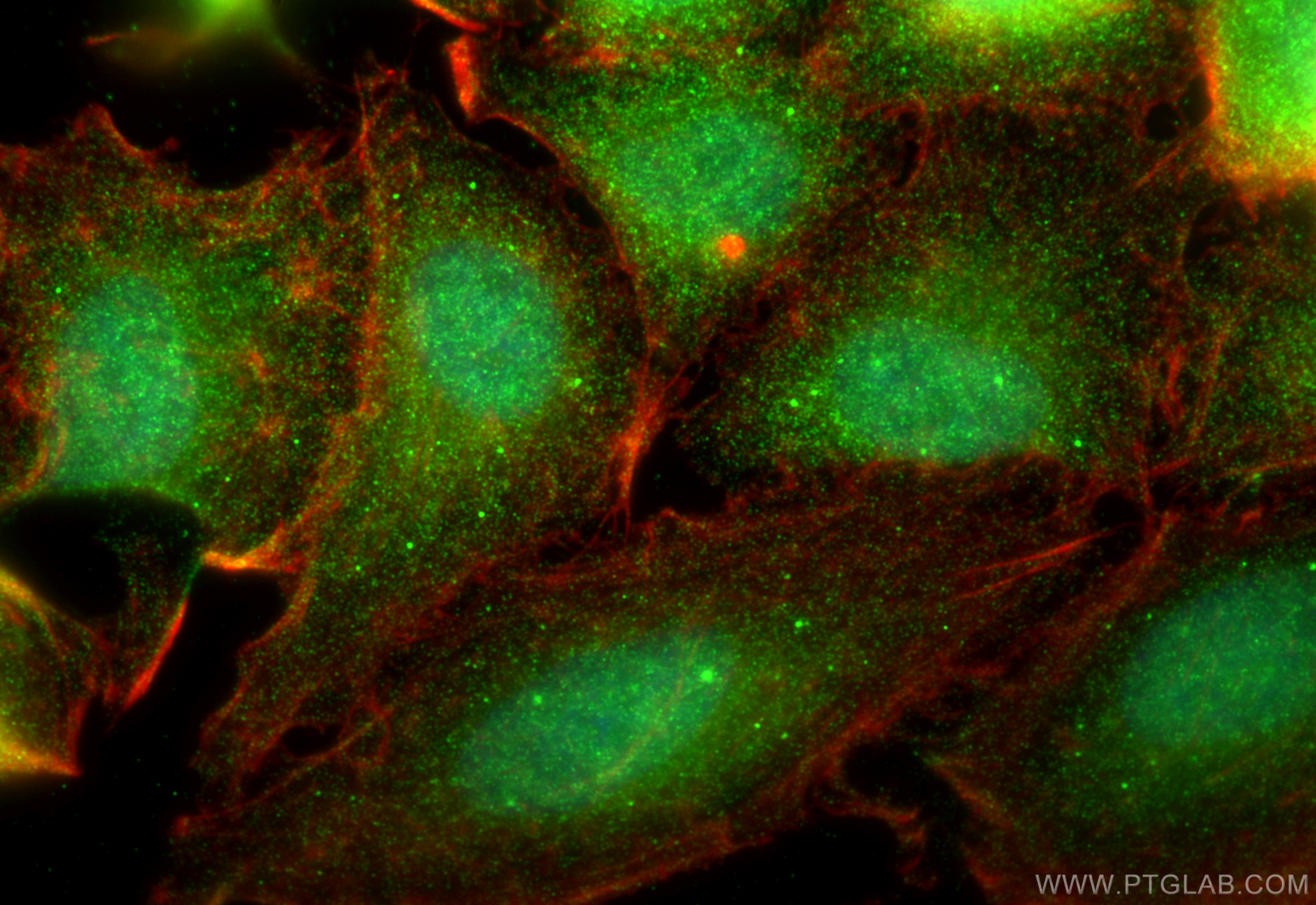 IF Staining of A549 using 55192-1-AP