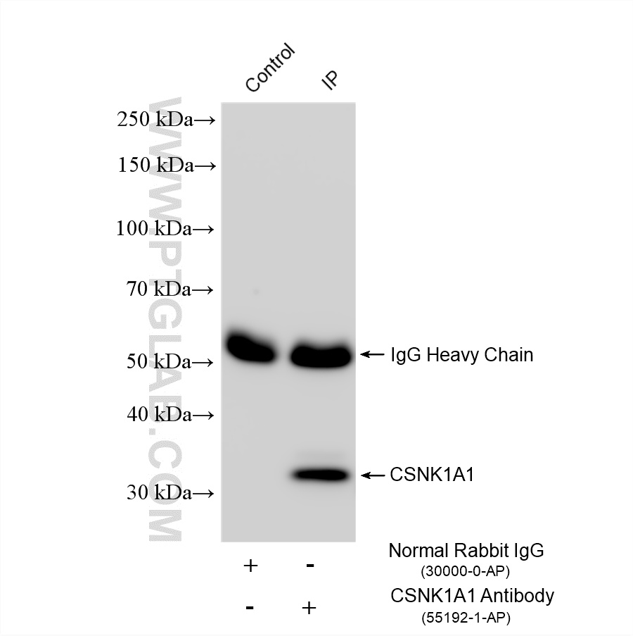 IP experiment of HeLa using 55192-1-AP