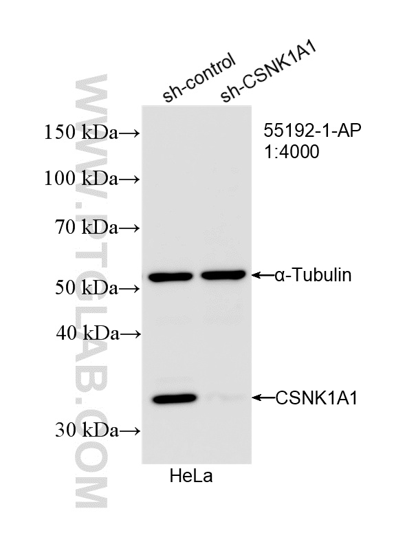 WB analysis of HeLa using 55192-1-AP