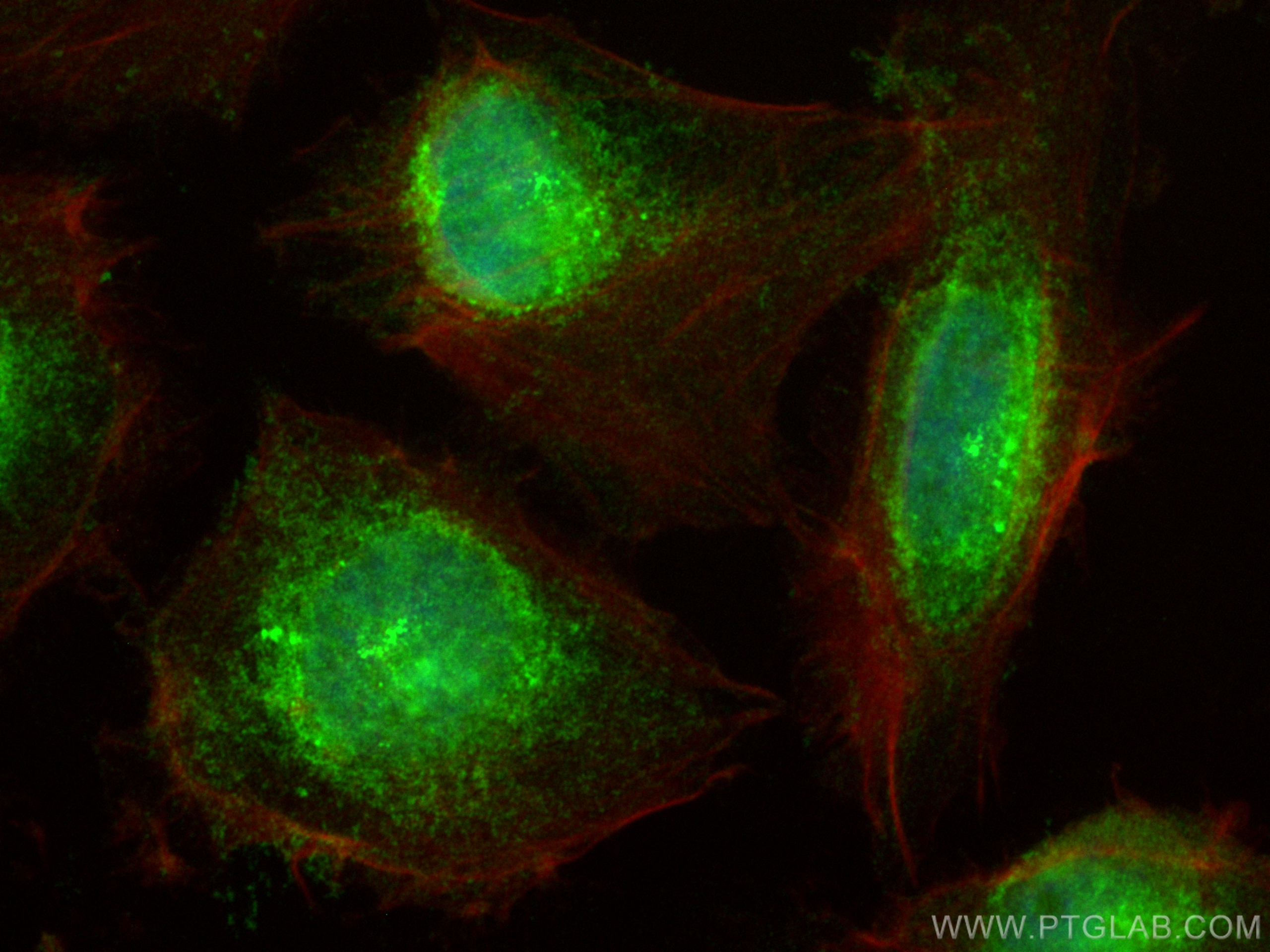 IF Staining of U-251 using 14388-1-AP