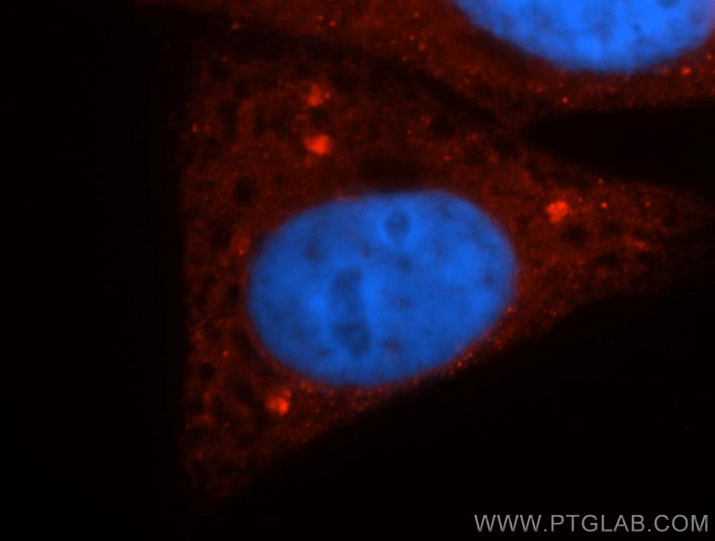 Casein Kinase 1 Delta