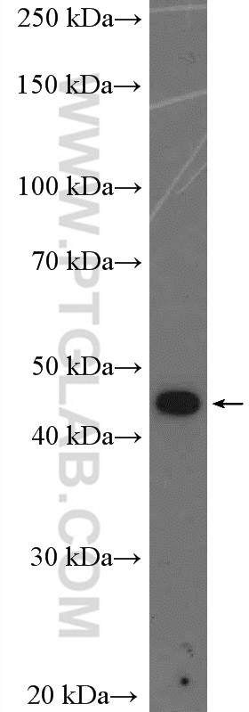 WB analysis of A431 using 11230-1-AP