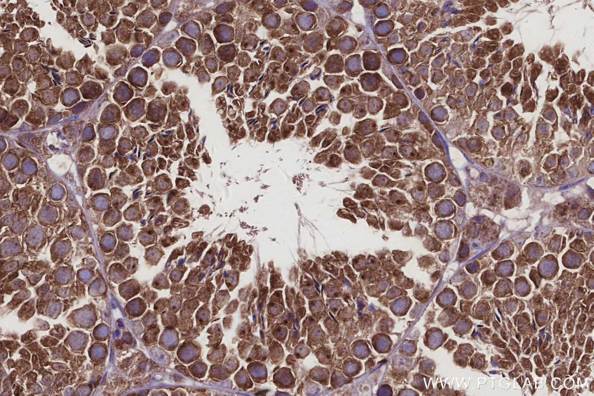 IHC staining of mouse testis using 16384-1-AP IHC staining of mouse testis using 16384-1-AP