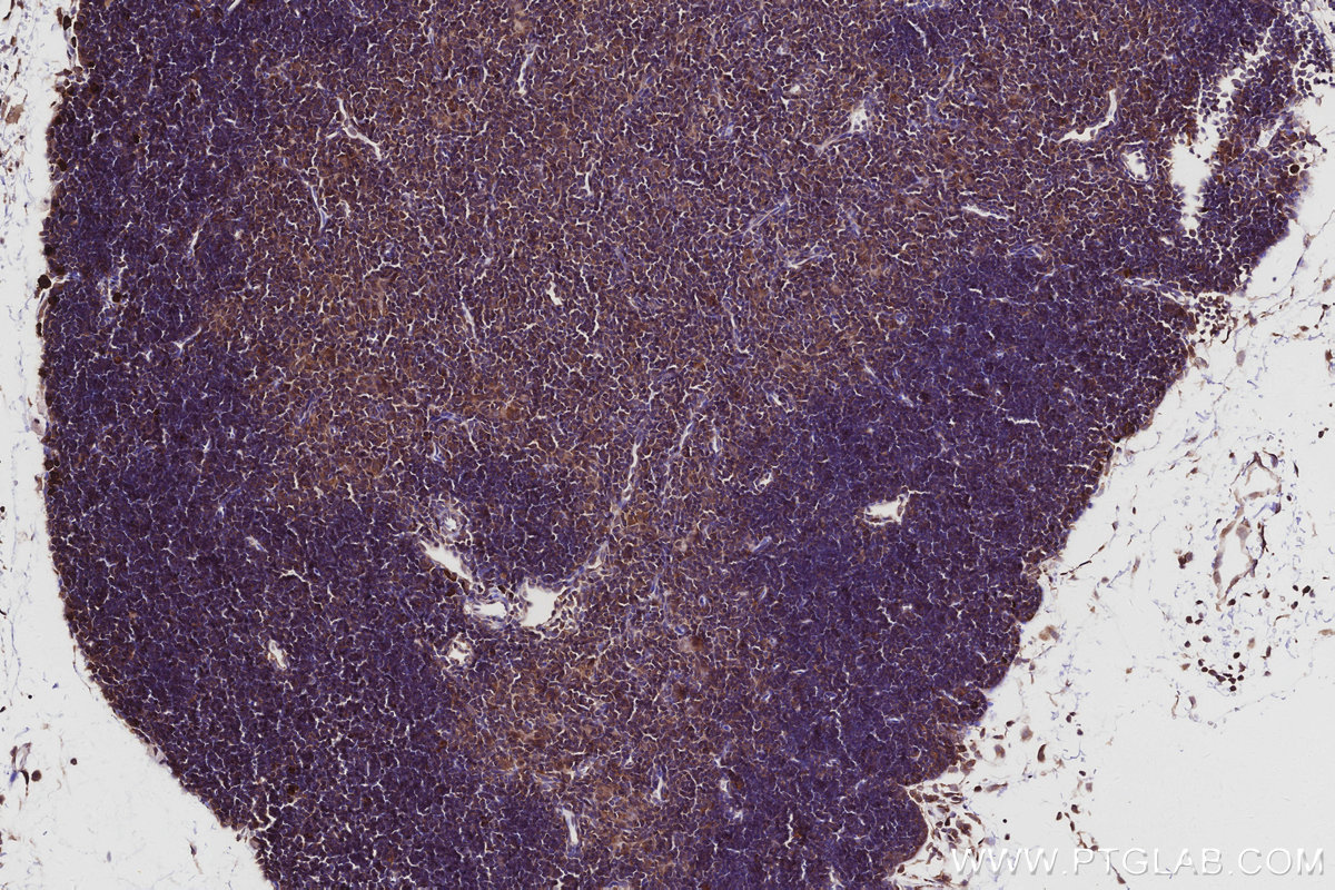 IHC staining of mouse thymus using 16384-1-AP IHC staining of mouse thymus using 16384-1-AP