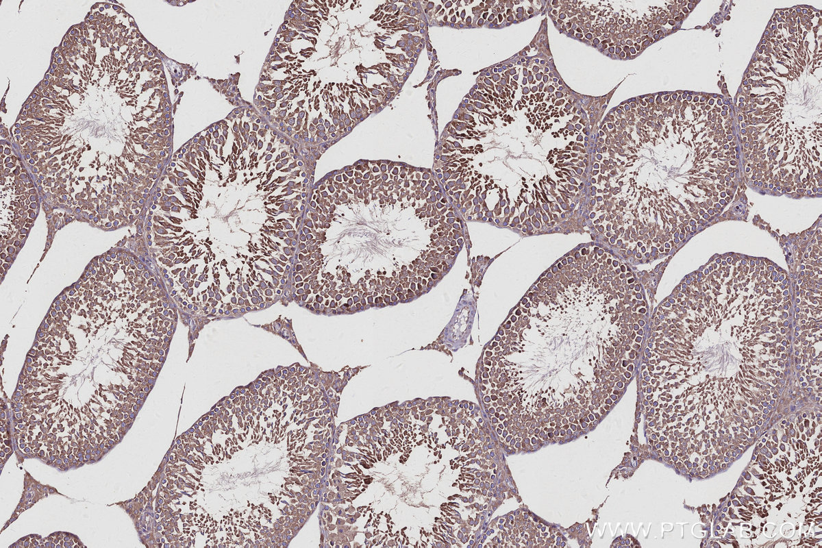 IHC staining of rat testis using 16384-1-AP IHC staining of rat testis using 16384-1-AP