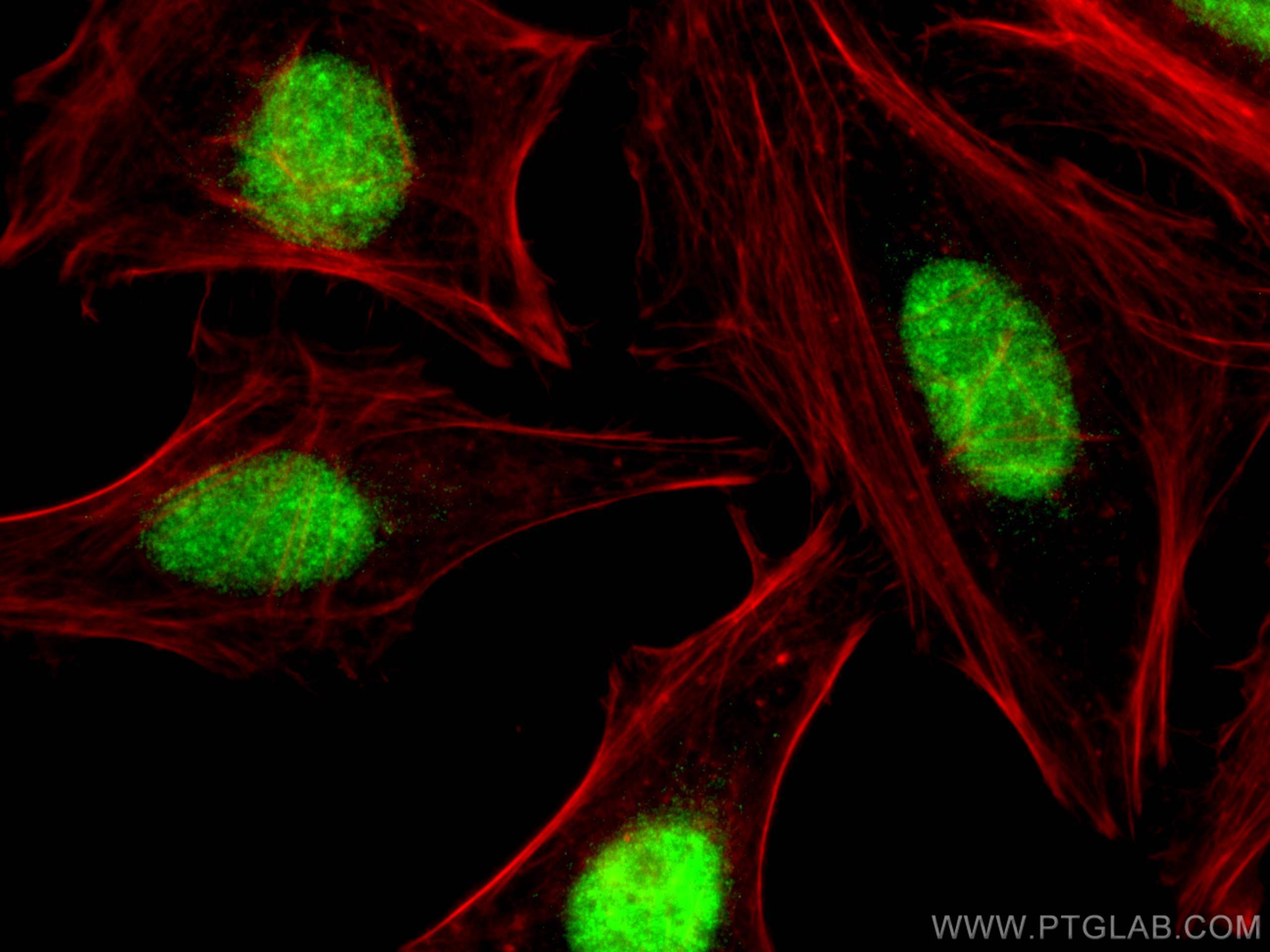 IF Staining of HeLa using 10992-1-AP