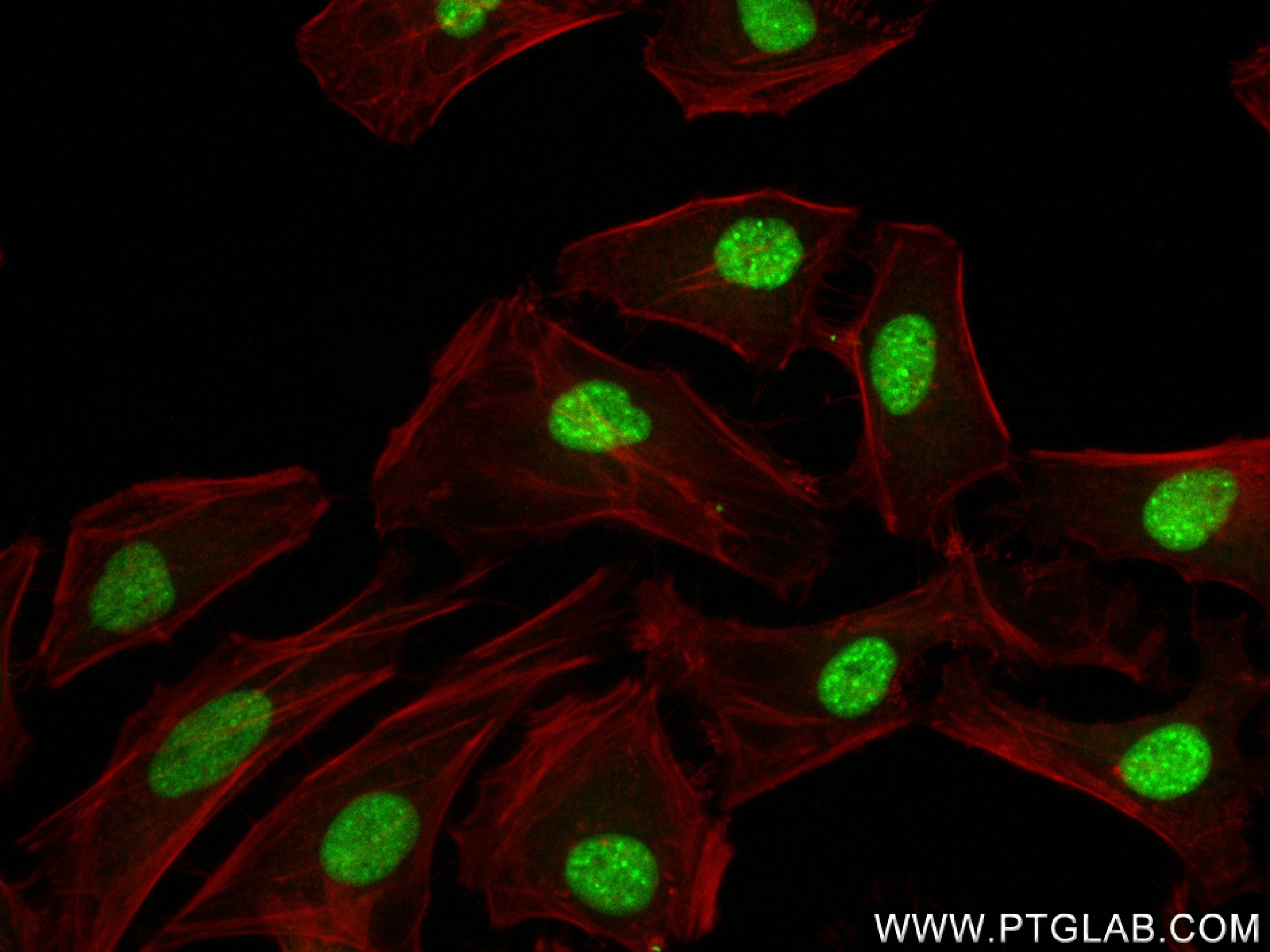 IF Staining of HeLa using 83805-4-RR (same clone as 83805-4-PBS)