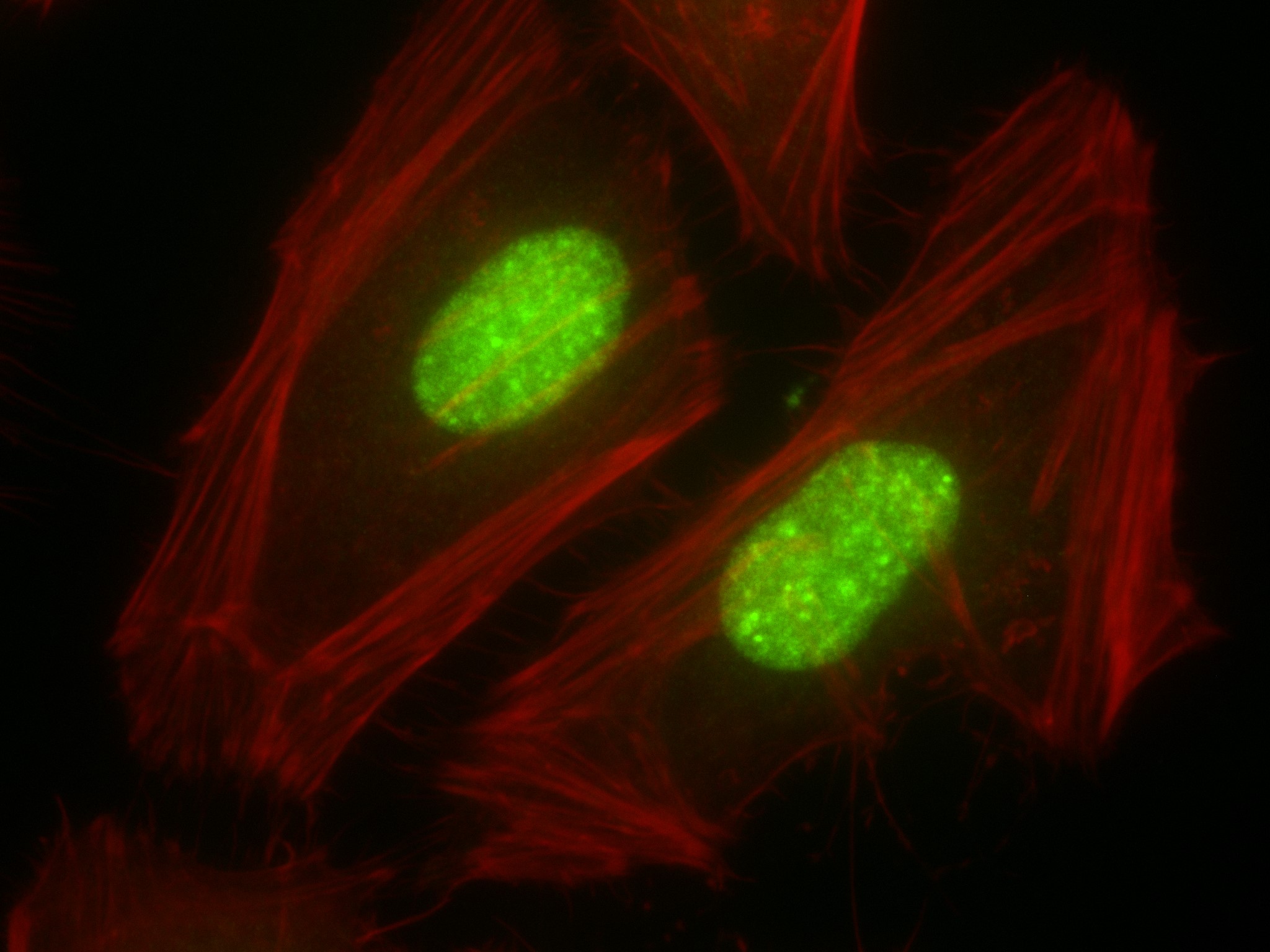 IF Staining of HeLa using 83805-4-RR (same clone as 83805-4-PBS)