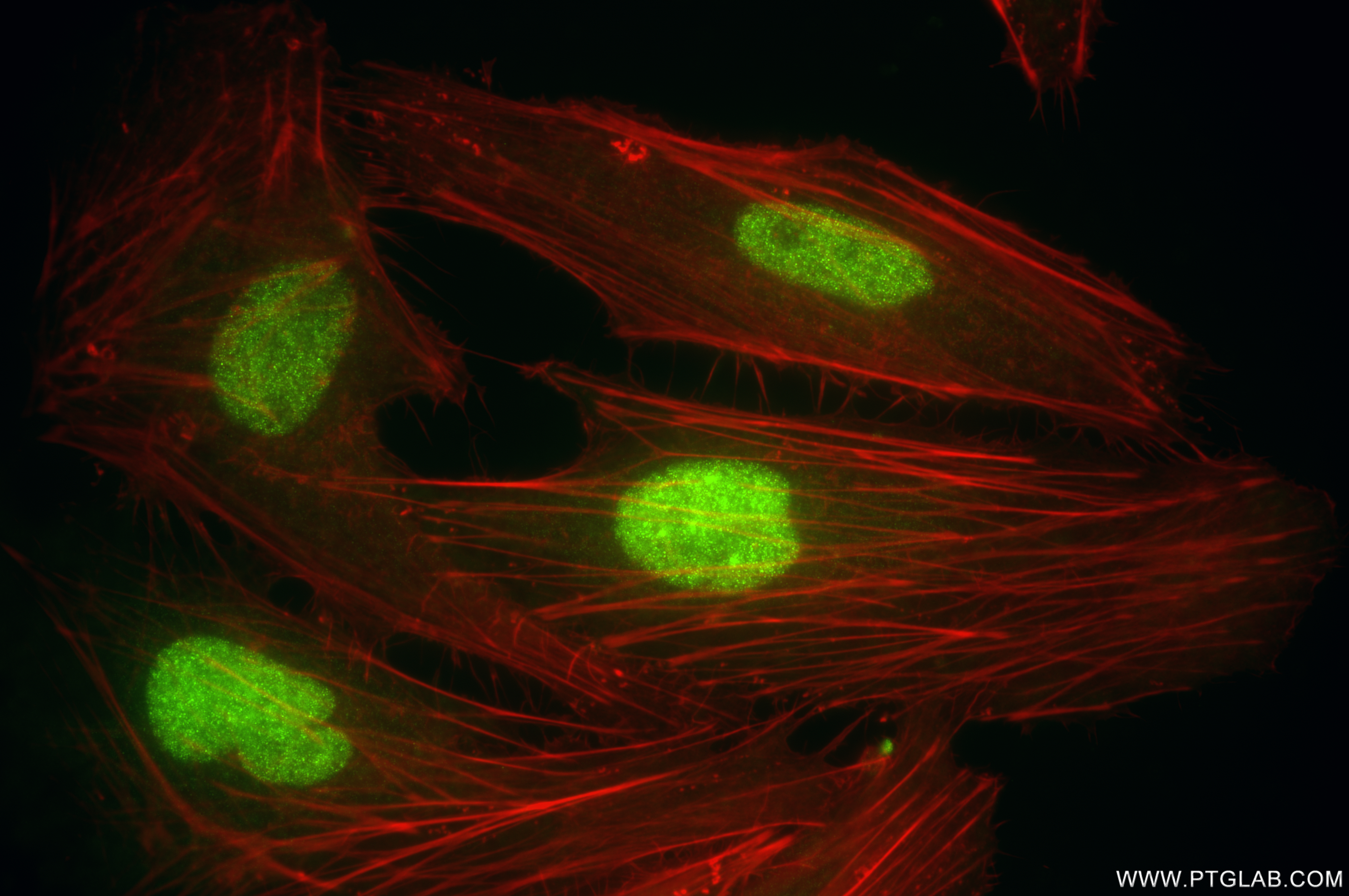 IF Staining of HeLa using 86169-2-RR (same clone as 86169-2-PBS)