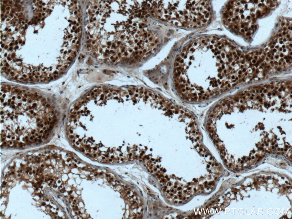 IHC staining of human testis using 22418-1-AP