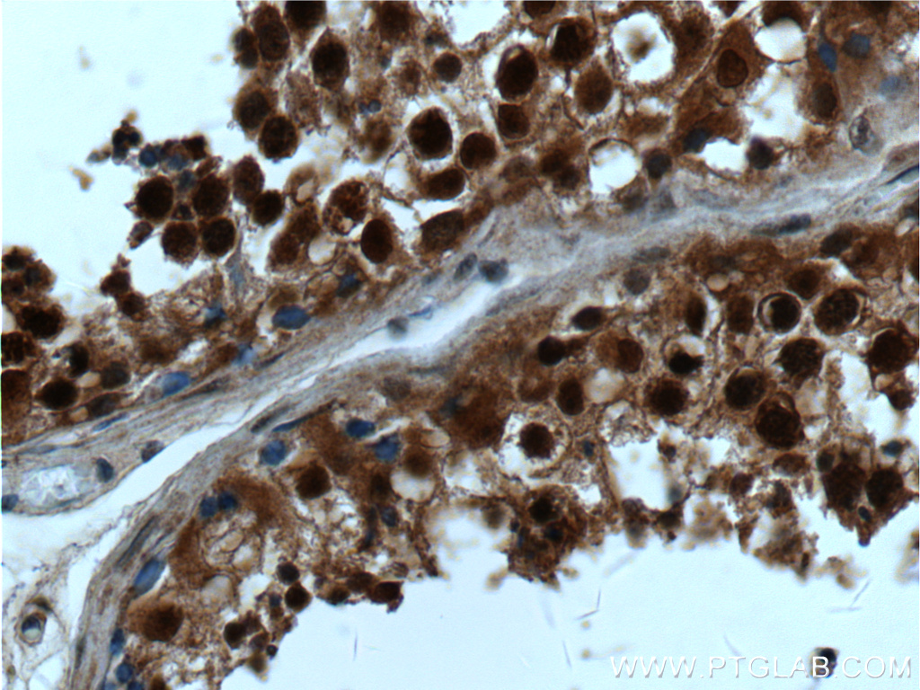 IHC staining of human testis using 22418-1-AP