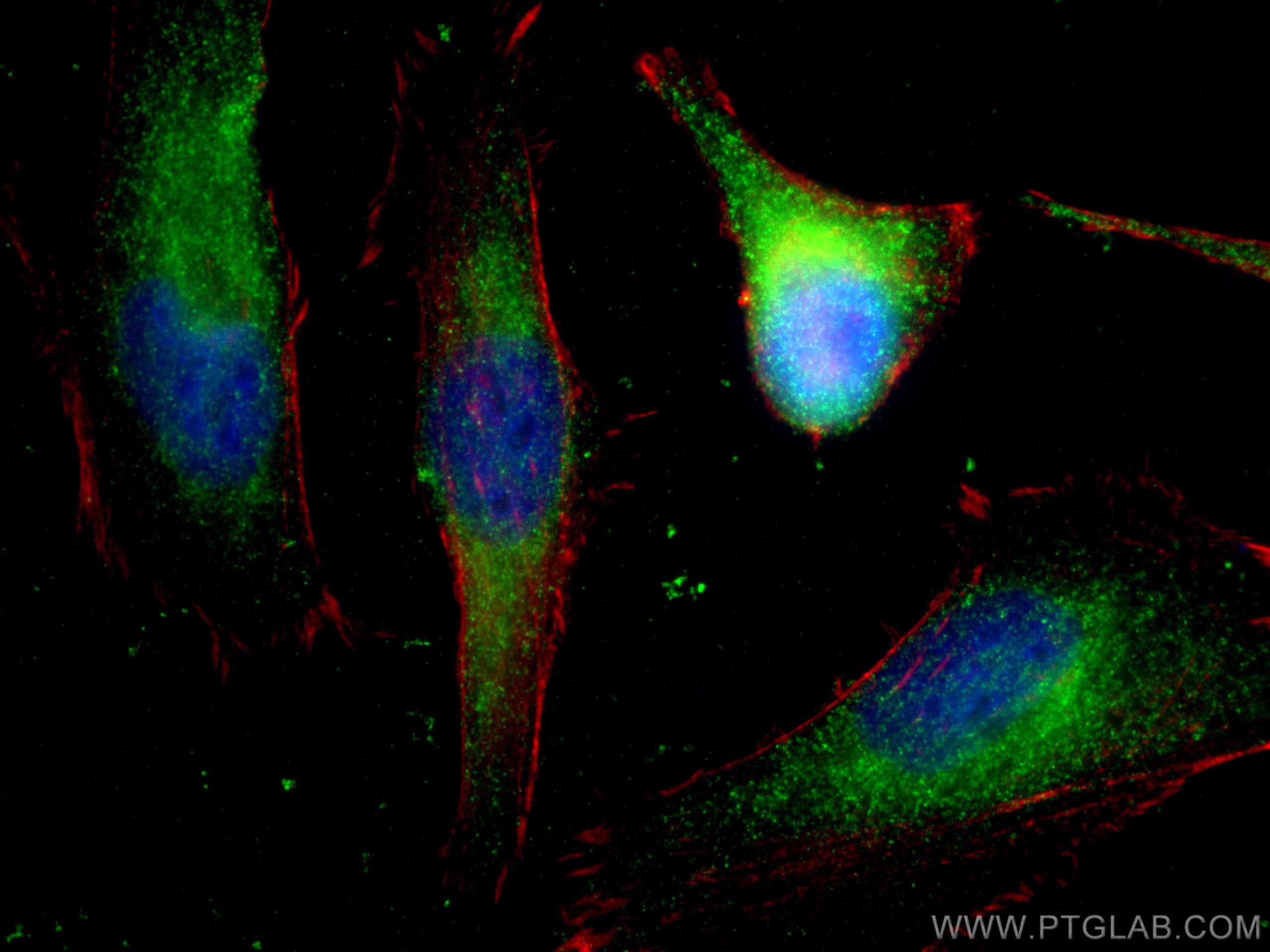 IF Staining of HeLa using 67866-1-Ig