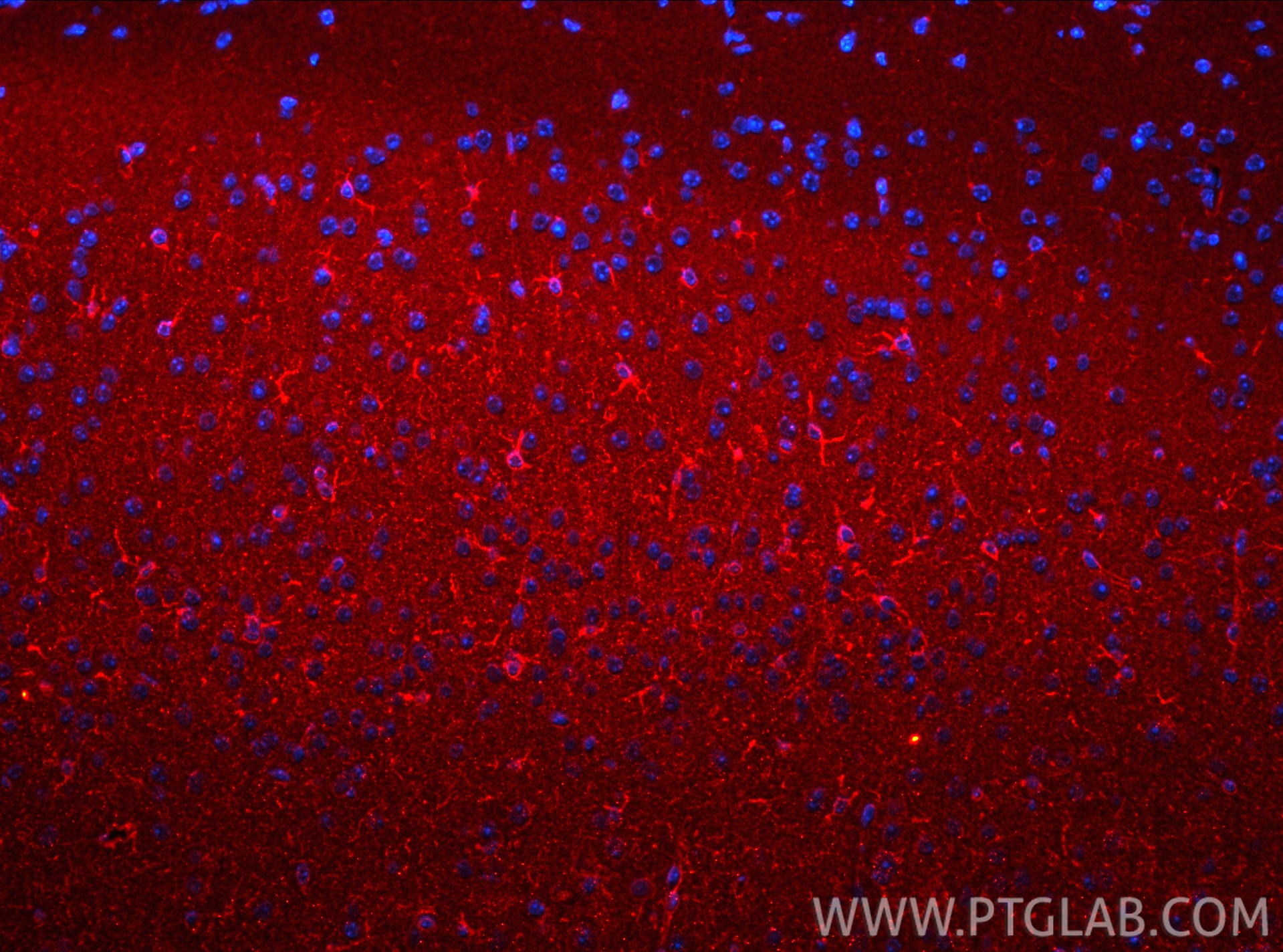 IF Staining of mouse brain using 31623-1-AP