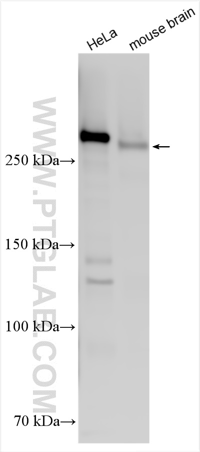 Various lysates were subjected to SDS PAGE followed by western blot with 31623-1-AP (CSPG4 antibody) at dilution of 1:800 incubated at room temperature for 1.5 hours. WB analysis using 31623-1-AP