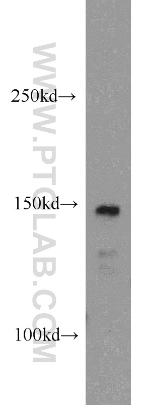 CSPP1 Polyclonal antibody