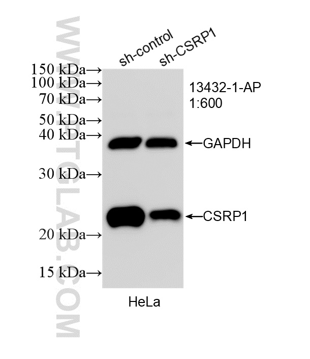 WB analysis of HeLa using 13432-1-AP WB analysis of HeLa using 13432-1-AP