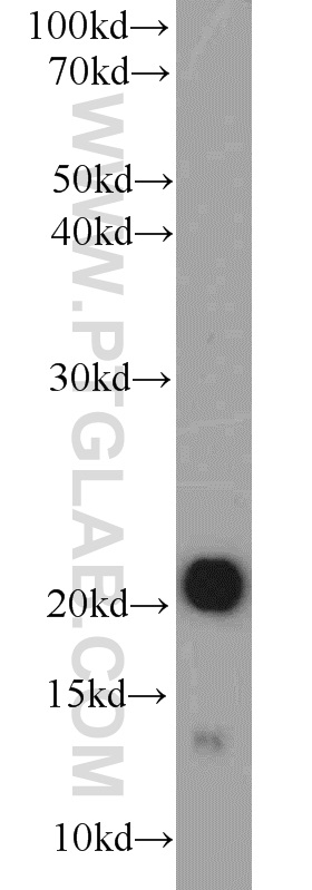 WB analysis of mouse heart using 10721-1-AP