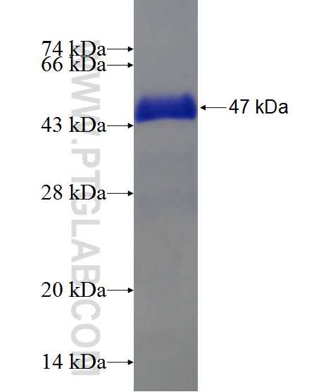 CSRP3 fusion protein Ag1136 SDS-PAGE