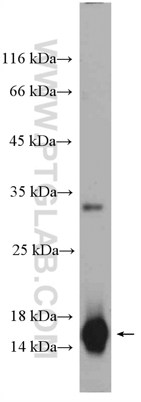 WB analysis of human saliva using 16025-1-AP