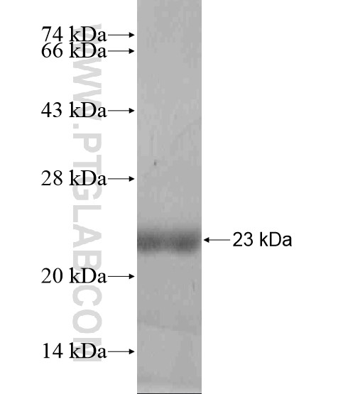CST11 fusion protein Ag18638 SDS-PAGE CST11 fusion protein Ag18638 SDS-PAGE