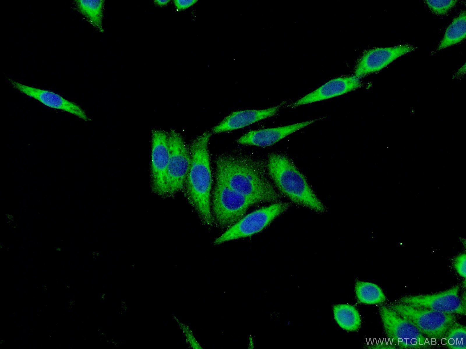 IF Staining of HeLa using 12245-1-AP