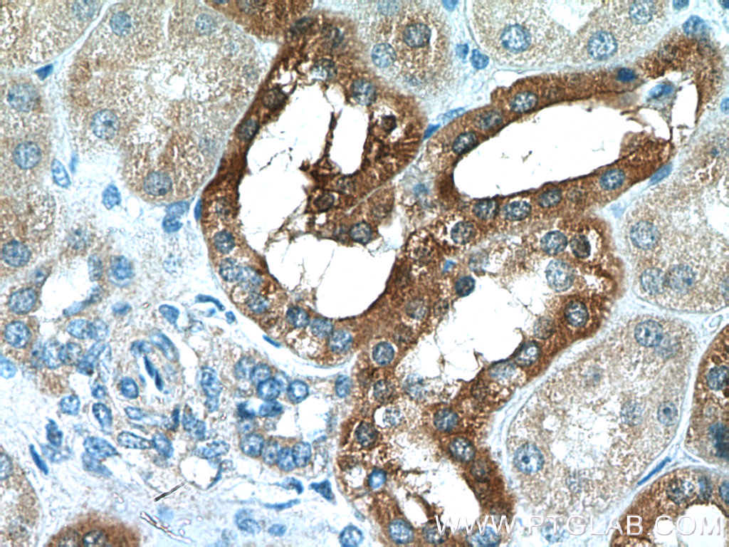 IHC staining of human kidney using 12245-1-AP