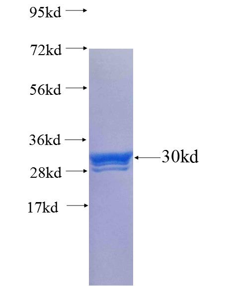 CST4 fusion protein Ag25619 SDS-PAGE